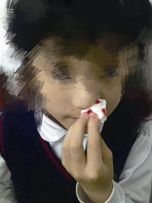 温州一小学被曝现“毒跑道” 一半以上孩子请病假