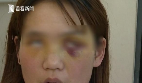 女子割双眼皮被无照医生切上睑眼睛无法睁开