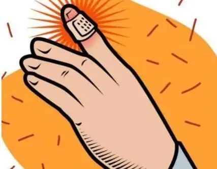 轻微伤鉴定标准?轻微伤赔偿15000合理吗?