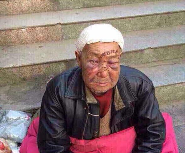 流浪汉的生命尊严为何被轻视