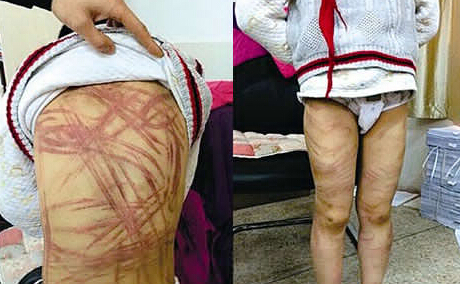 公安部打拐办主任反对虐童案养母不予批捕