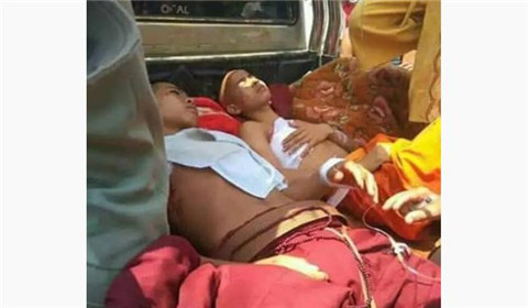 缅甸小和尚把地雷当球踢 玩了几天突然爆炸