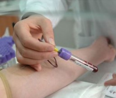 亲子鉴定怎么做?什么条件下可以做亲子鉴定?