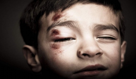 2019年小孩子在幼儿园受伤谁负责?意外受伤如何赔偿?