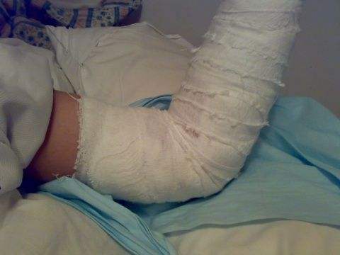 2019年人身损害赔偿诉讼怎么收费？胜诉后由被告承担吗？