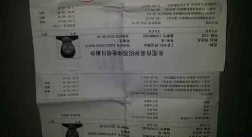 入职需要体检吗？入职体检需要体检什么？