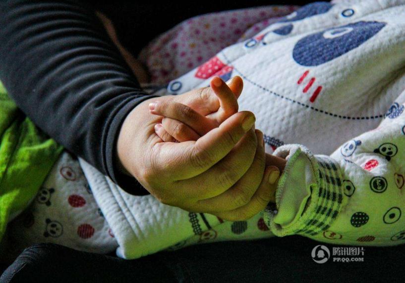 国家有对脑瘫儿童有补助吗?2022脑瘫儿童补助标准